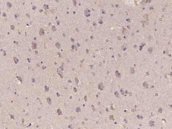 IDH1 Rabbit Polyclonal Antibody