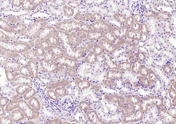 IDH1 Rabbit Polyclonal Antibody