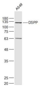 DSPP Rabbit Polyclonal Antibody