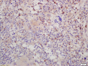 DSPP Rabbit Polyclonal Antibody