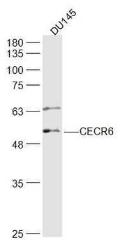 CECR6 Rabbit Polyclonal Antibody