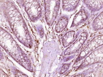 P150 CAF1 Rabbit Polyclonal Antibody