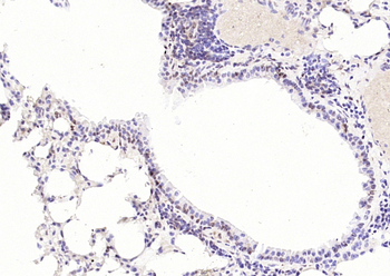 P53 (FL-393) Rabbit Polyclonal Antibody