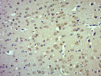 TRPM4 Rabbit Polyclonal Antibody
