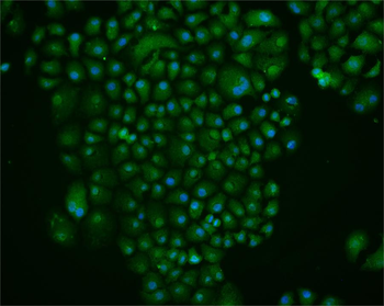 TET1 Rabbit Polyclonal Antibody