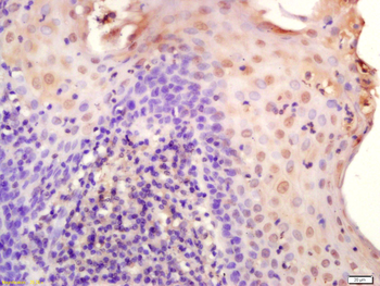 TET1 Rabbit Polyclonal Antibody