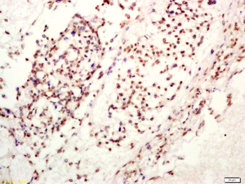 TET1 Rabbit Polyclonal Antibody