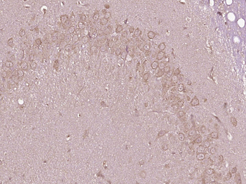 TSPAN5 Rabbit Polyclonal Antibody