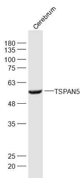 TSPAN5 Rabbit Polyclonal Antibody