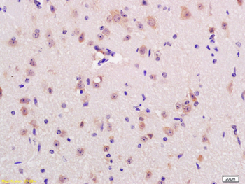 RNF123 Rabbit Polyclonal Antibody