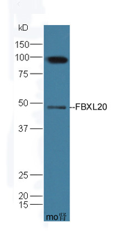 FBXL20 Rabbit Polyclonal Antibody