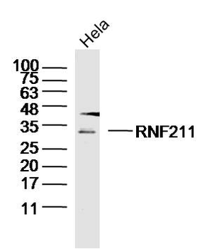 RNF211 Rabbit Polyclonal Antibody