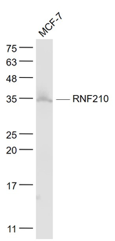 RNF210 Rabbit Polyclonal Antibody