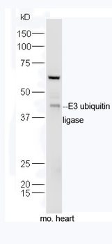 E3 ubiquitin ligase Rabbit Polyclonal Antibody