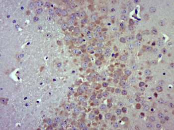 PRMT5 Rabbit Polyclonal Antibody