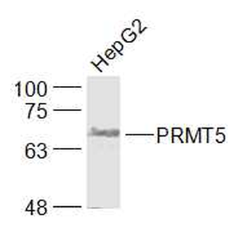 PRMT5 Rabbit Polyclonal Antibody