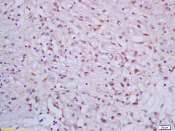 APC70 Rabbit Polyclonal Antibody