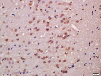 P70 S6 kinase beta Rabbit Polyclonal Antibody