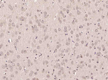 PAG608 Rabbit Polyclonal Antibody