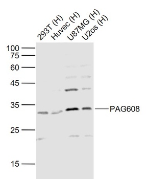 PAG608 Rabbit Polyclonal Antibody