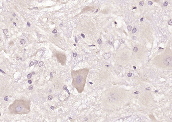 RNF213 Rabbit Polyclonal Antibody