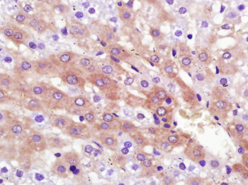 RNF213 Rabbit Polyclonal Antibody