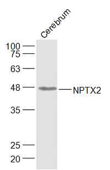 NPTX2 Rabbit Polyclonal Antibody