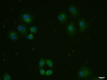 Ox-LDL Rabbit Polyclonal Antibody