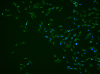 Beta galactosidase Rabbit Polyclonal Antibody