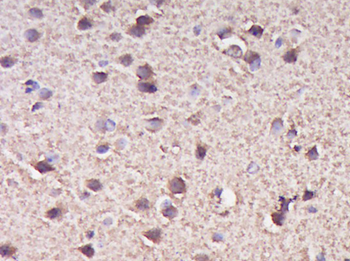 Metallothionein 3 Rabbit Polyclonal Antibody