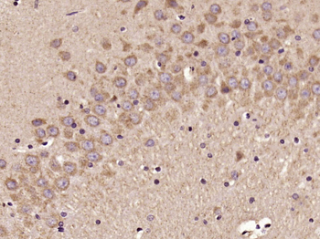 Elastin Rabbit Polyclonal Antibody