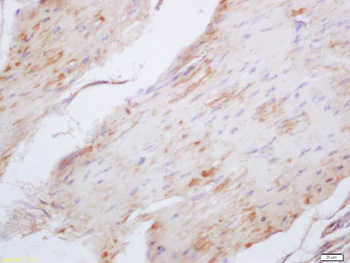 Elastin Rabbit Polyclonal Antibody
