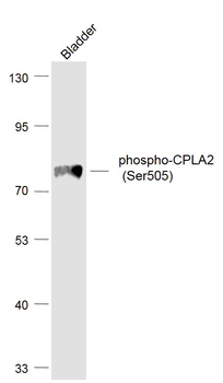 Phospho-CPLA2 (Ser505) Rabbit Polyclonal Antibody