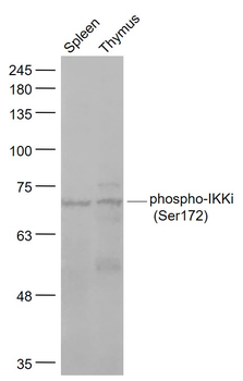 Phospho-IKKi (Ser172) Rabbit Polyclonal Antibody