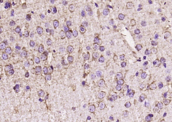 Optimedin Rabbit Polyclonal Antibody