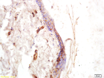 COL6A5 Rabbit Polyclonal Antibody