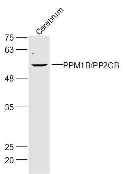 Gliomedin Rabbit Polyclonal Antibody