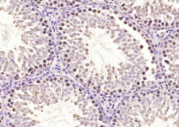 H2AX (Ubiquityl Lys119) Rabbit Polyclonal Antibody