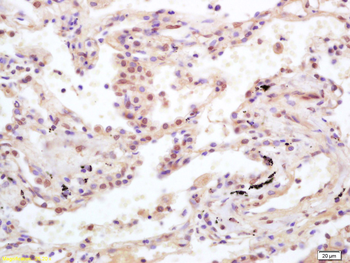 H2AX (Ubiquityl Lys119) Rabbit Polyclonal Antibody