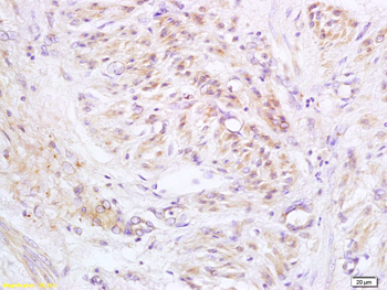 ABCD3 Rabbit Polyclonal Antibody