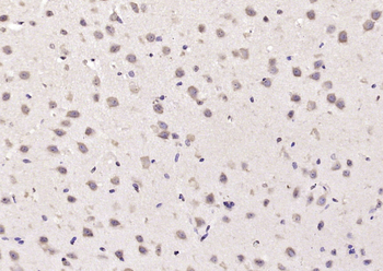 ATAT1 Rabbit Polyclonal Antibody