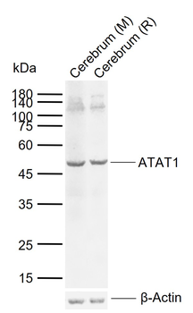 ATAT1 Rabbit Polyclonal Antibody