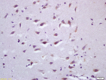 KIF1B Rabbit Polyclonal Antibody