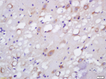 NETO1 Rabbit Polyclonal Antibody