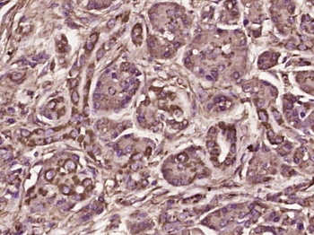 Transglutaminase 2 Rabbit Polyclonal Antibody