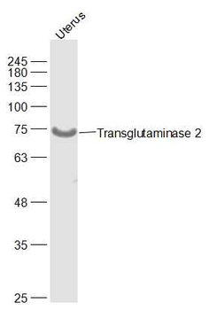 Transglutaminase 2 Rabbit Polyclonal Antibody
