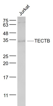 TECTB Rabbit Polyclonal Antibody