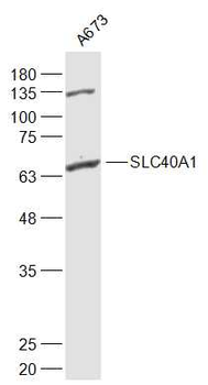 SLC40A1 Rabbit Polyclonal Antibody