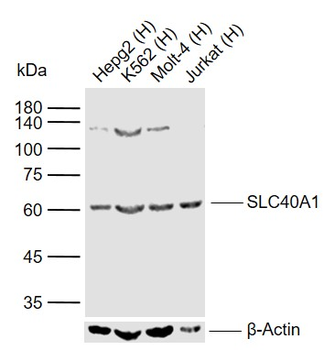 SLC40A1 Rabbit Polyclonal Antibody