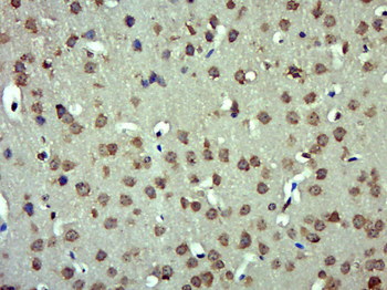 Angiotensin II Rabbit Polyclonal Antibody